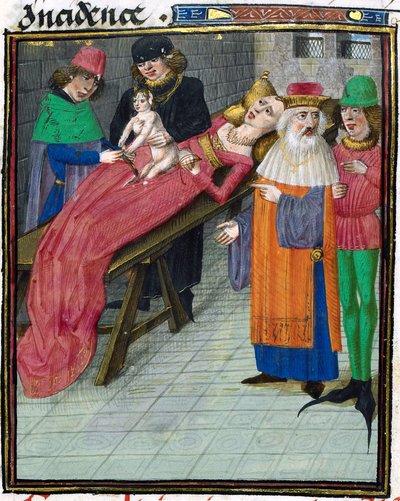 Medieval Depiction of Caesarian Birth by Unbekannt Unbekannt